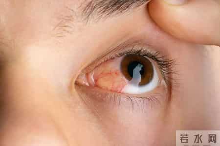 一种巨伤眼的行为，很多女生最近都在做！（不是戴美瞳）