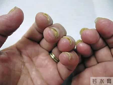 不建议你一过年就爱美甲的原因是:可能会影响补牙!