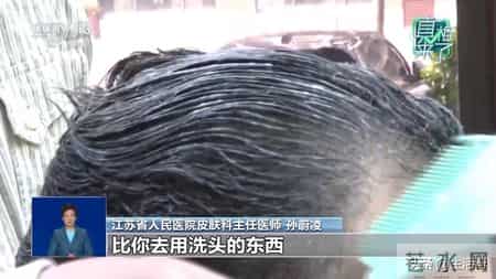 白头发“一洗就能黑”？专家：白发无法逆转