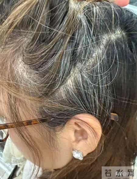 年过四十，朱雀三啄缓解白发焦虑，告别频繁染发