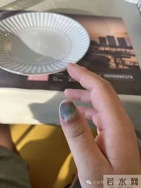 网友记录手指甲掉落的全过程