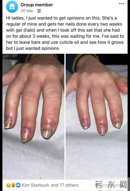 不建议你一过年就爱美甲的原因是:可能会影响补牙!