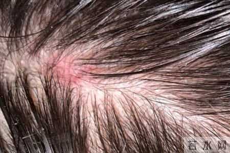 遭官方曝光的毒洗发水,很多家庭还在用,难怪头发越来越少