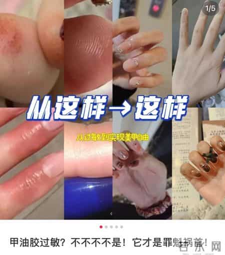 不建议你一过年就爱美甲的原因是:可能会影响补牙!