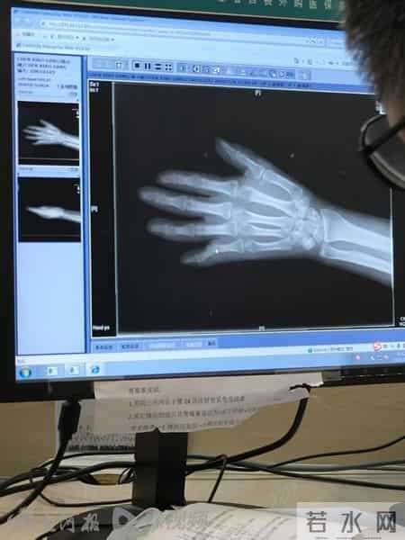 上海一司机加油站加油遇溢油,静电起火致全身49%烧伤,加油站被判担责后上诉称无过错