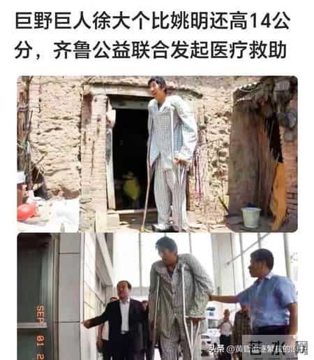 一个身高2米4的山东汉子走了，才35岁！他被身高拖垮的一生
