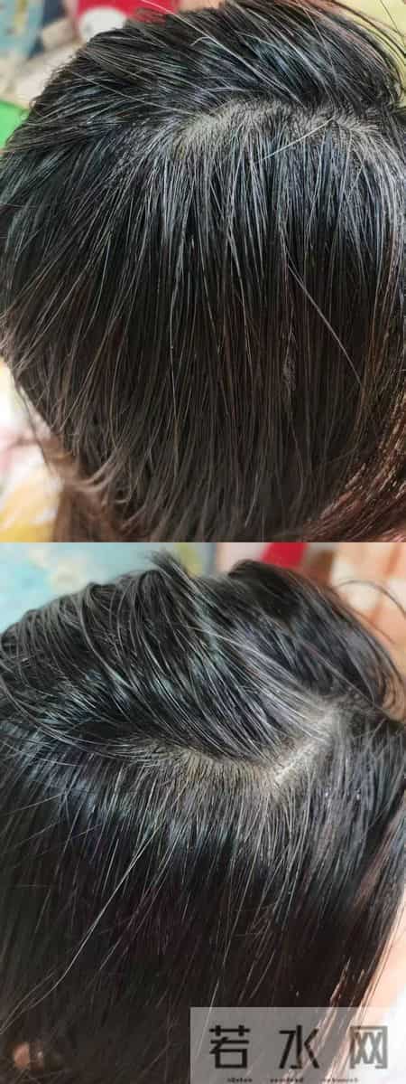 “逆转白发”产品五花八门，专家：不如好好吃饭睡觉