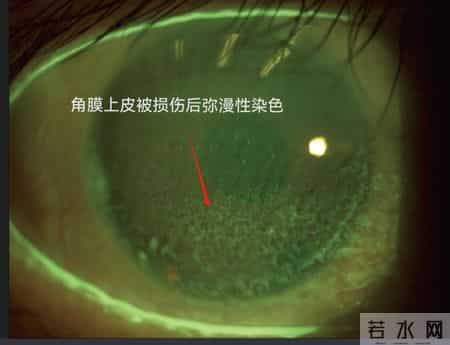 一种巨伤眼的行为，很多女生最近都在做！（不是戴美瞳）