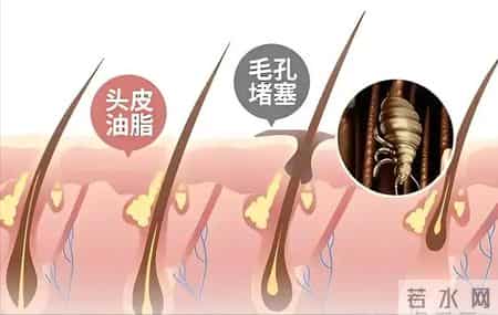 上海一女子用“硫磺皂”洗头，坚持半年后，出现了这4个变化