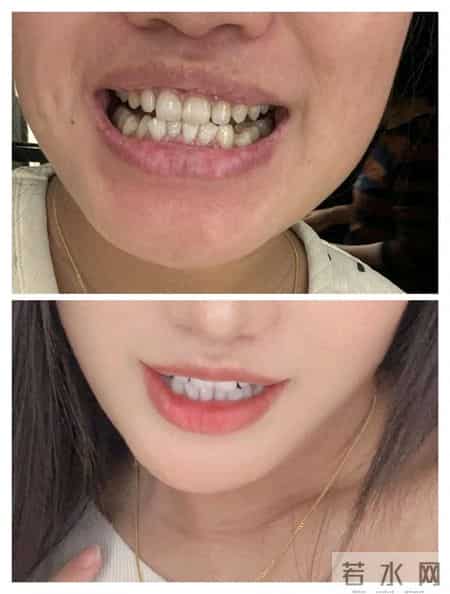 什么牌子牙膏效果好还不贵?懂行必入的10款排行榜