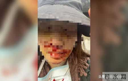 绍兴顶包案藏细节!律师谈金晨到底算不算肇事逃逸?_0