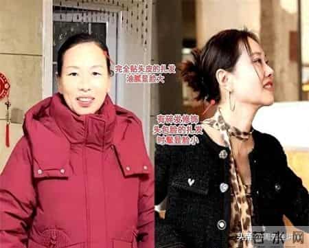 为什么我劝白发奶奶：少剪短发、多扎发？看这3组对比图你就懂了