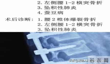 伤残鉴定水很深？